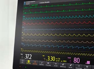 Звуки Кардиомонитора - остановка сердца, реанимация, пиканье в больнице